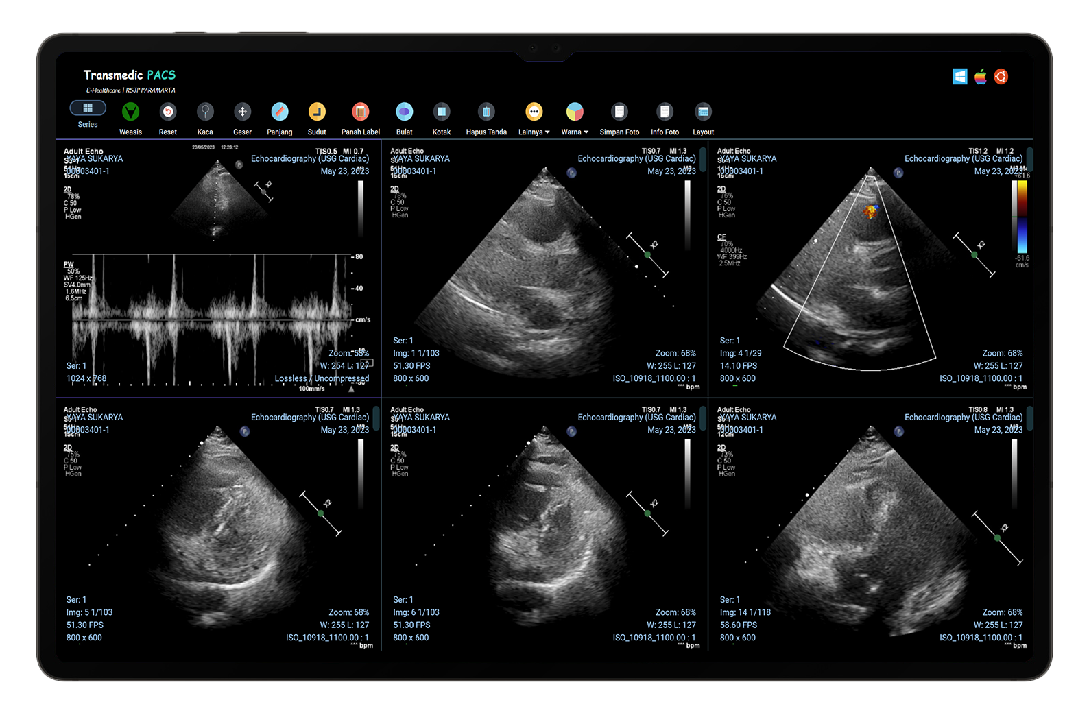 Picture Archiving & Communication System PACS