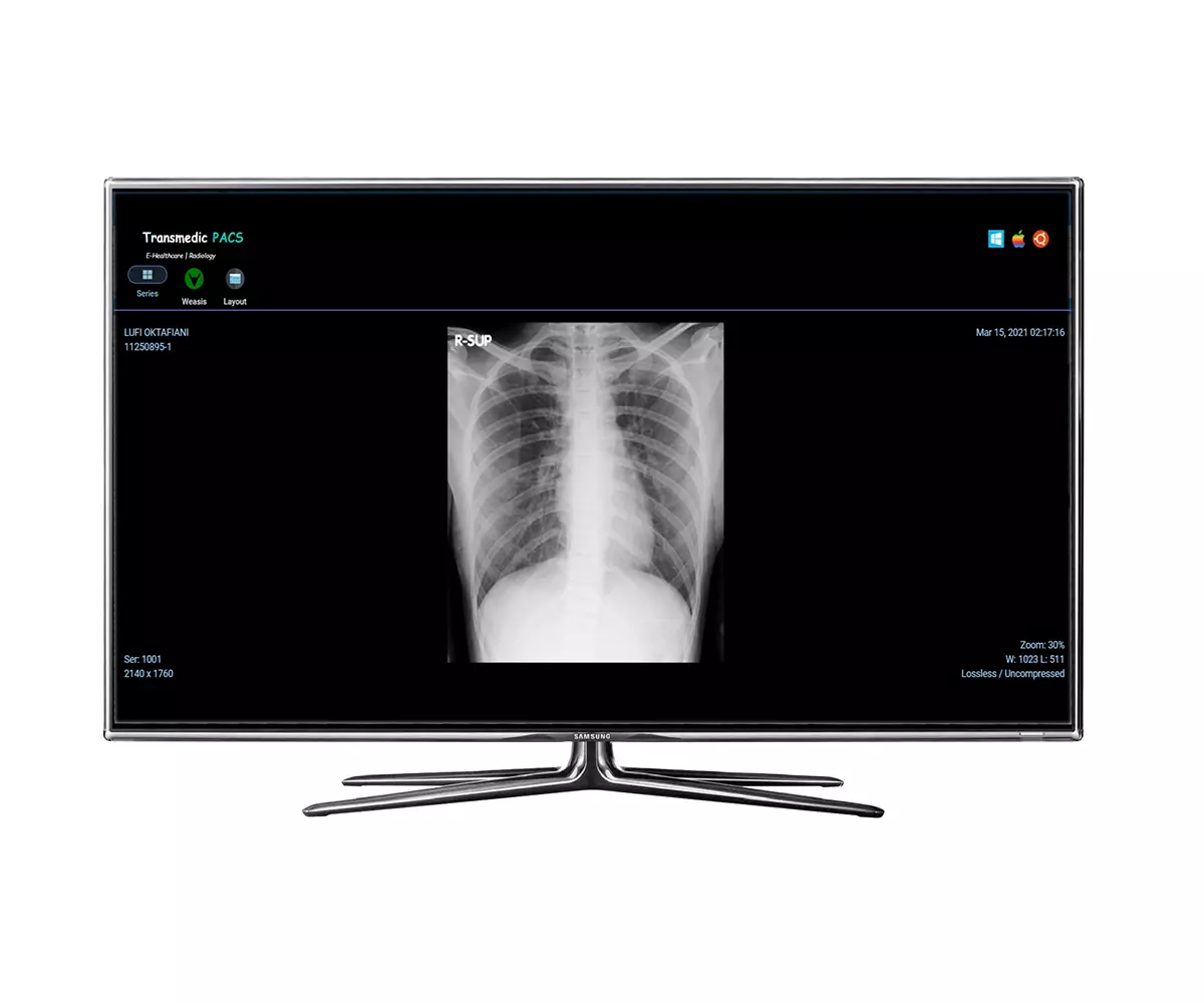 Picture Archiving & Communication System PACS
