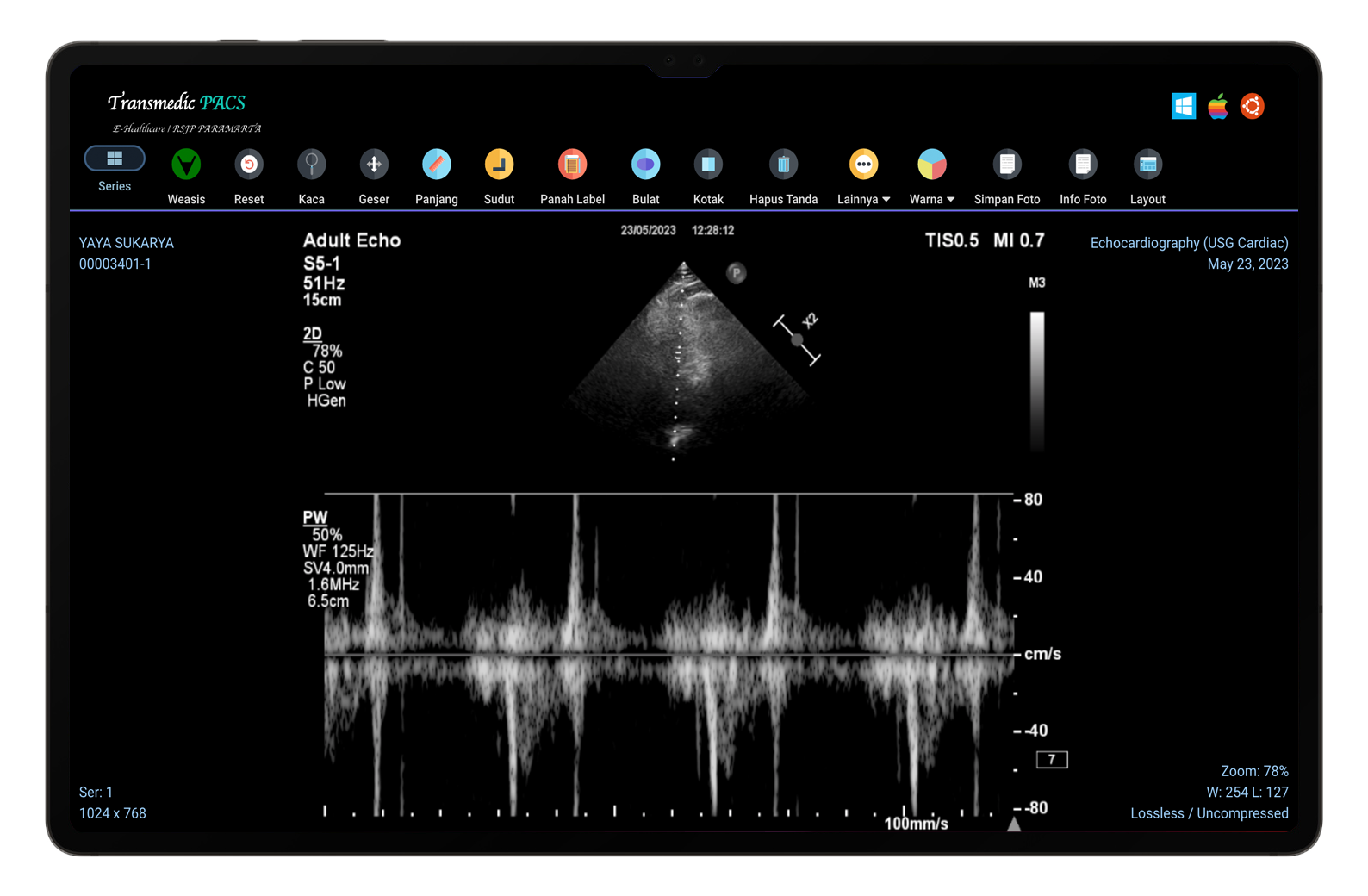 Picture Archiving & Communication System PACS
